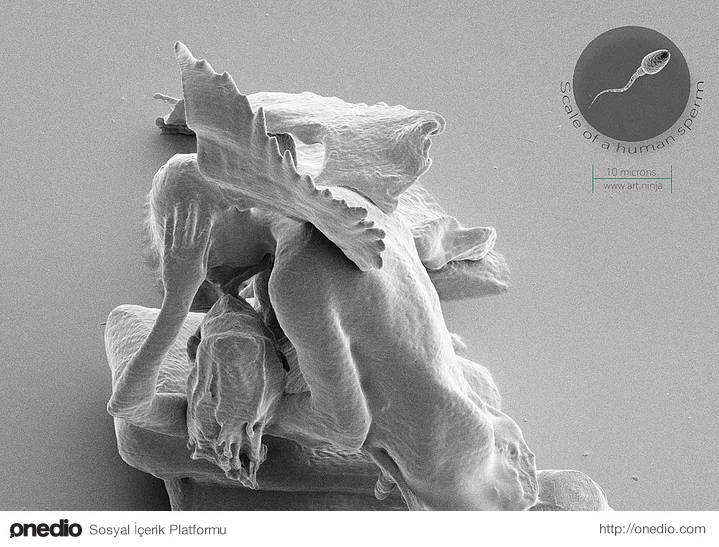 Bir insan sperminin görülebileceği ölçeğe ayarlanmış mikroskop görüntüsü