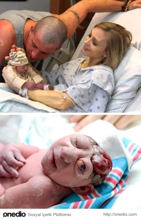 Doğuştan özrü olan bebeğin fotoğrafını kaldırdılar.